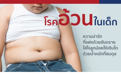 การคัดกรองโรคอ้วนในเด็ก