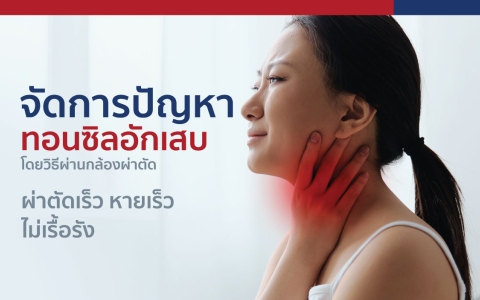 จัดการปัญหา ทอนซิลอักเสบ โดยวิธีผ่านกล้องผ่าตัด