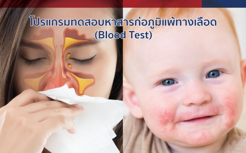 โปรแกรมทดสอบหาสารก่อภูมิแพ้ทางเลือด (Blood Test)