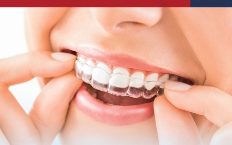 Invisalign