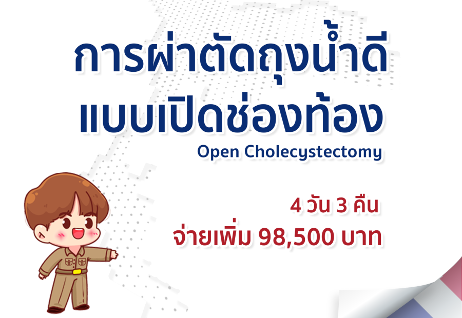 การผ่าตัดถุงน้ำดีแบบเปิดช่องท้อง Open Cholecystectomy