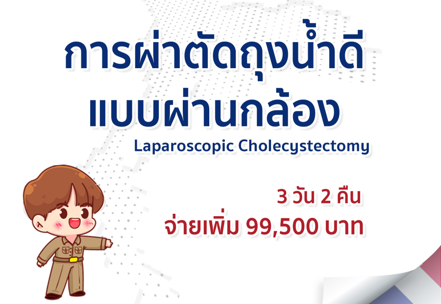 การผ่าตัดถุงน้ำดีแบบผ่านกล้อง Laparoscopic Cholecystectomy