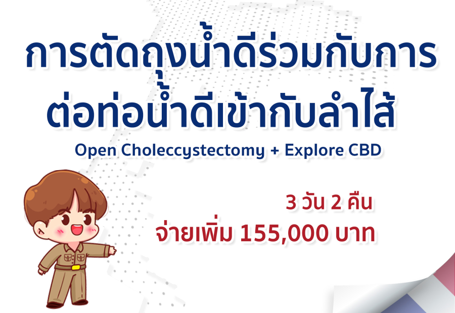 การตัดถุงน้ำดีร่วมกับการต่อท่อน้ำดีเข้ากับลำไส้