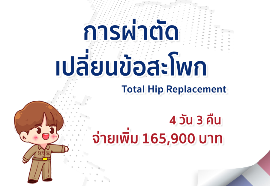การผ่าตัดเปลี่ยนข้อสะโพก