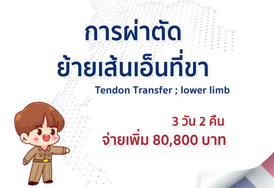 การผ่าตัดย้ายเส้นเอ็นที่ขา