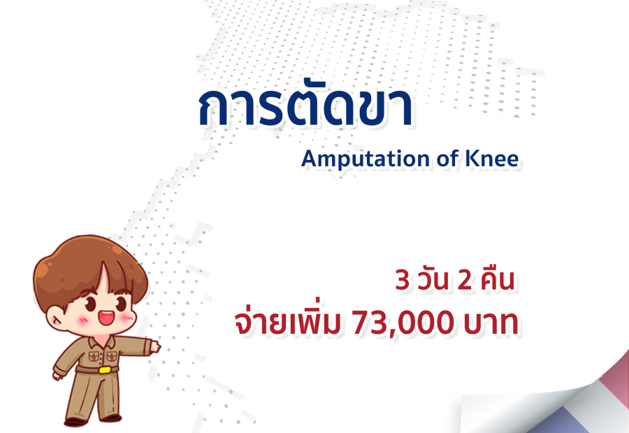 การตัดขา