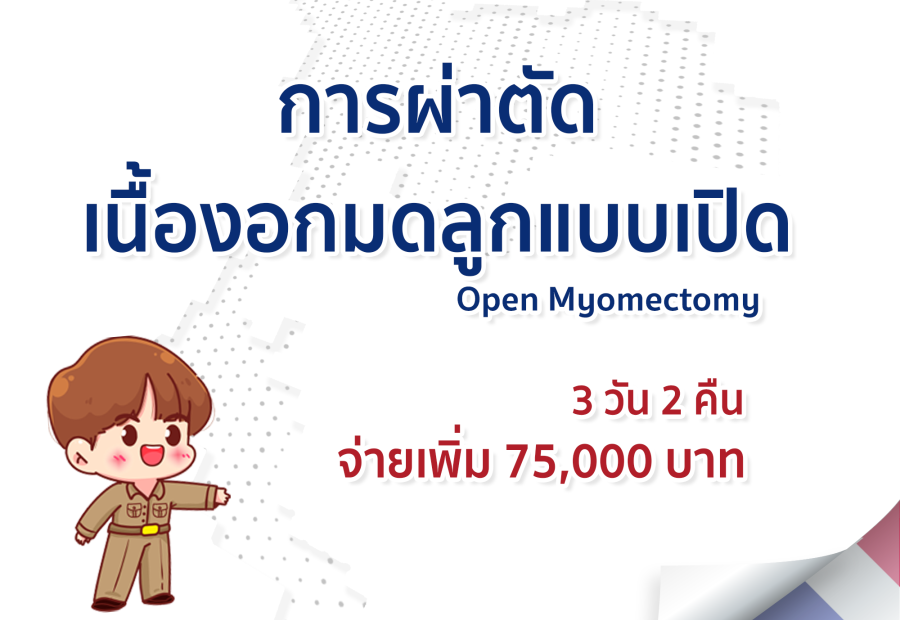 การผ่าตัดเนื้องอกมดลูกแบบเปิด
