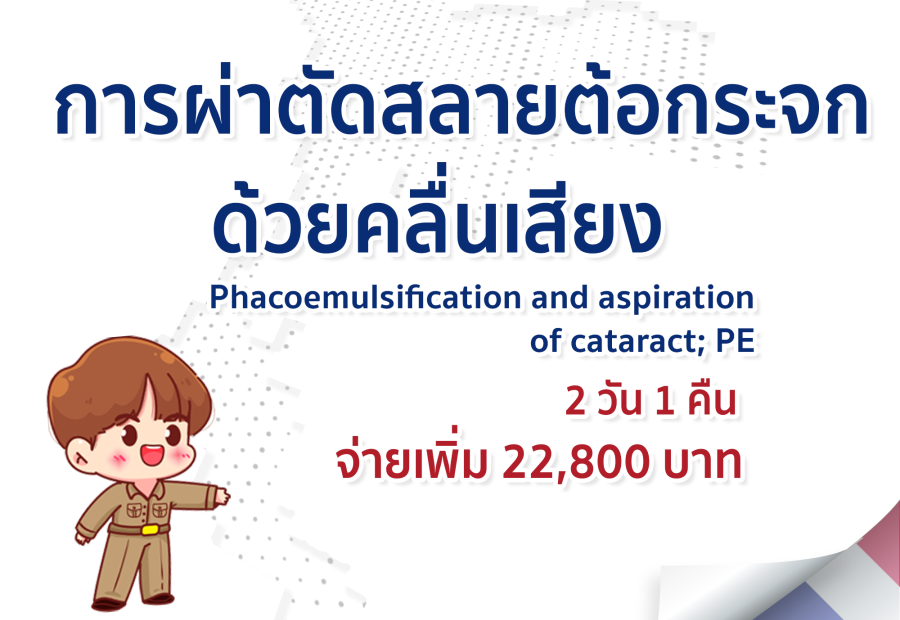 การผ่าตัดสลายต้อกระจกด้วยคลื่นเสียง