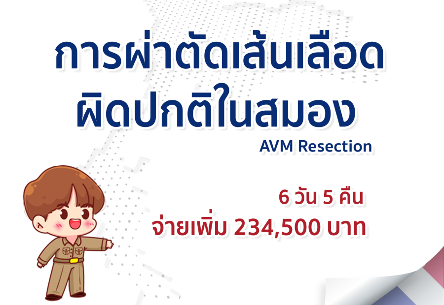 การผ่าตัดเส้นเลือดผิดปกติในสมอง