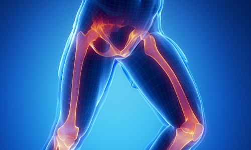 What is Causing my Back Pain, Stiffness, and Leg Pain?