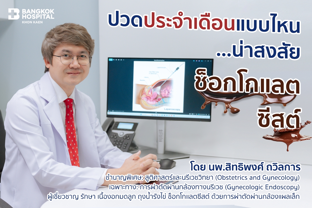 ช็อกโกแลตซีสต์