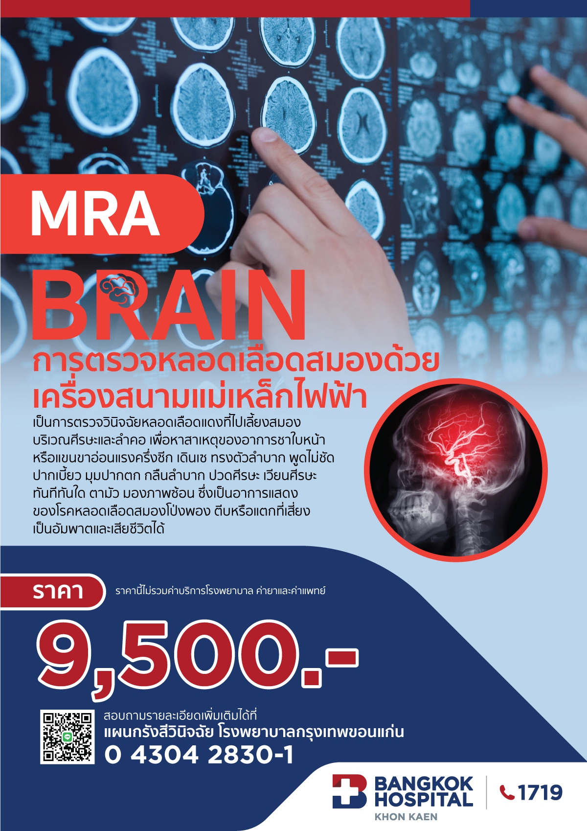 MRA BRAIN การตรวจหลอดเลือดสมองด้วยเครื่องสนามแม่เหล็กไฟฟ้า