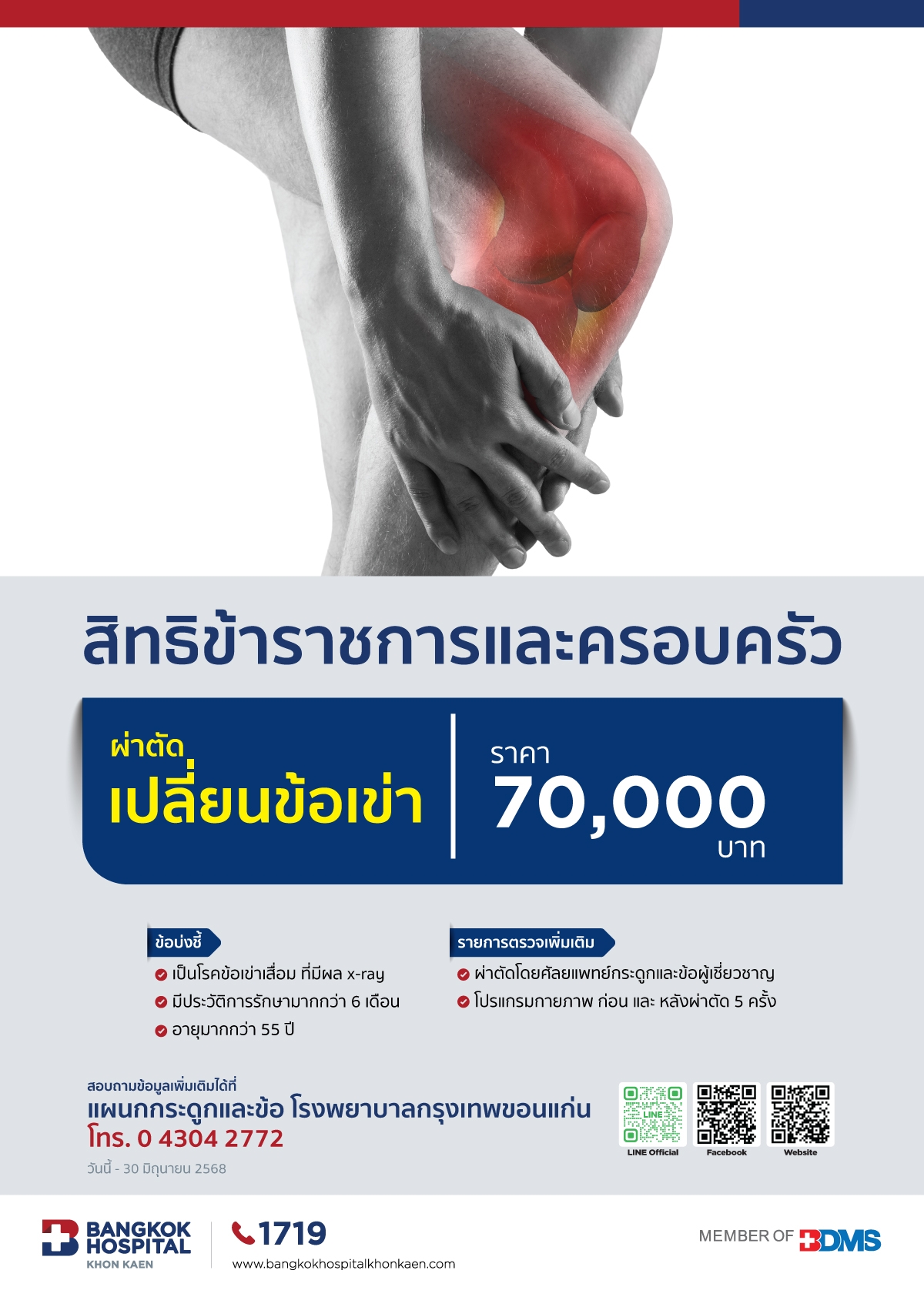 ผ่าตัดเปลี่ยนข้อเข่า