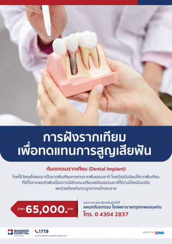 การฝังรากเทียม เพื่อทดแทนการสูญเสียฟัน