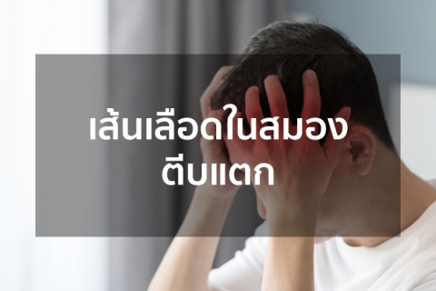 เส้นเลือดในสมองตีบแตก
