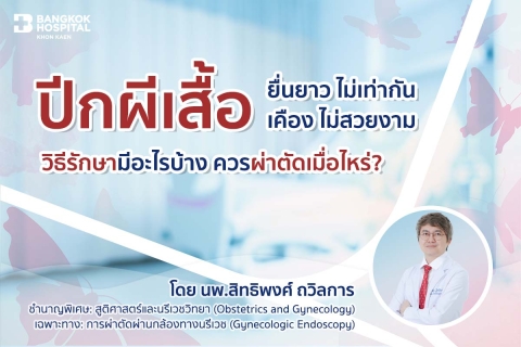 ปีกผีเสื้อ