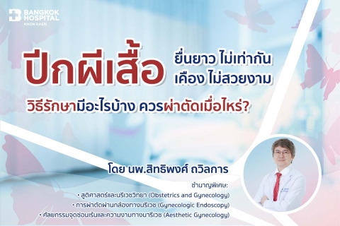 ปีกผีเสื้อ
